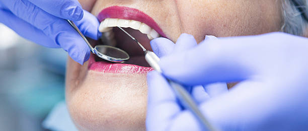 Best Emergency Root Canal Treatment in Alamo Heights, TX