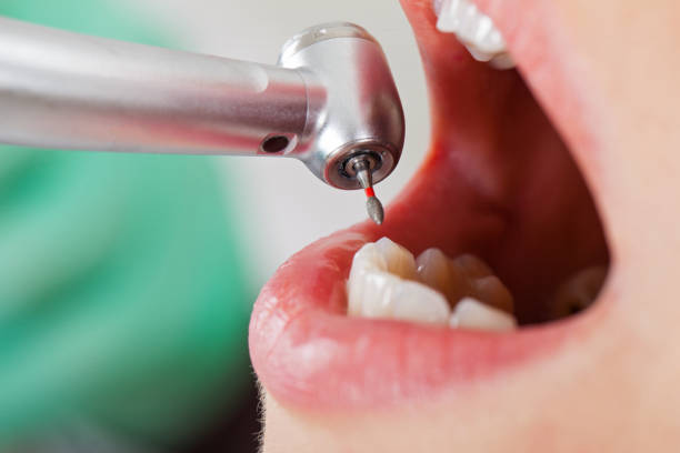 Best Pediatric Emergency Dentist in Alamo Heights, TX